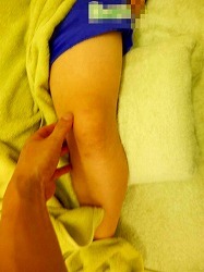 オスグッド　バスケ　中学女子　膝の痛み