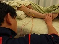 若葉治療院(本院)のブログ-アキレス腱炎　アキレス腱の痛み