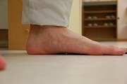 　　　若葉治療院(本院)のブログ-足底筋膜炎　足の裏の痛み