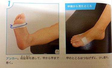 　　　若葉治療院(本院)のブログ-足底筋膜炎　テーピング　貼り方