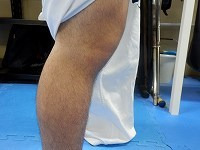 　　　若葉治療院(本院)のブログ-オスグッド　膝の痛み