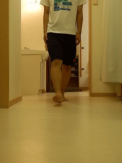 ランニング障害　膝の痛み　半月板損傷