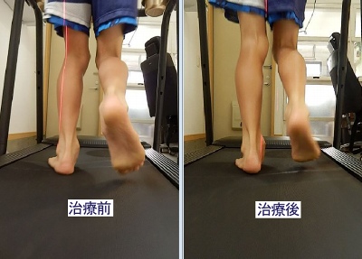 足関節と膝関節の協調運動